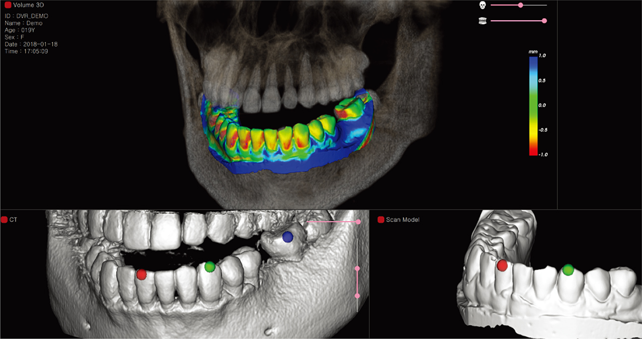 Digital Dentistry Software SMDsolution